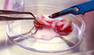 Dental stem cells